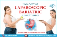 Laparoscopic Bariatric Surgery Cost india