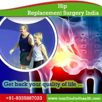 Affordable Hip Replacement Surgery India