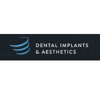 Dental Implants & Aesthetics