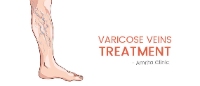 Vericose Veins Surgeon