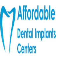 Affordable Dental Implants Queens