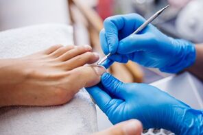 Professional Ingrown Toenail Clinic Assistance