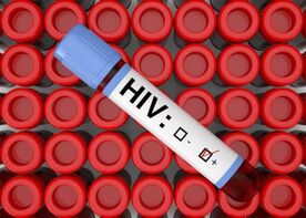 Advanced Detection:  4th Generation HIV Testing Centers