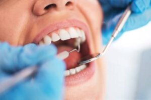 A Guide to Choosing the Best Emergency Dental Services in Toronto