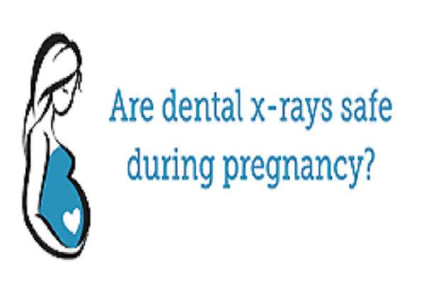 Dental Care and X-rays, are they safe during pregnancy?