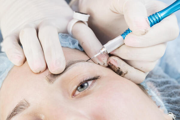 Eyebrow Transplantation