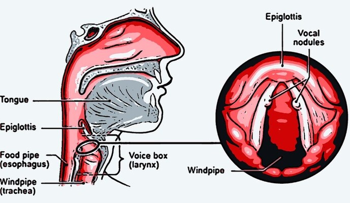 Vocal Cord Nodules in Children: Causes, Symptoms, and Treatment Options