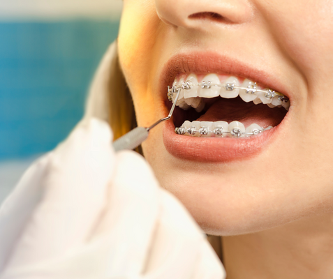 Orthodontic Options in Miramar, FL