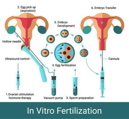 What Makes The IVF Process So Difficult?