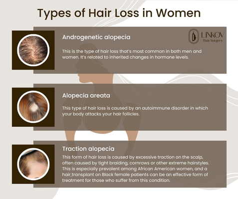 Hair Loss Treatments for Women