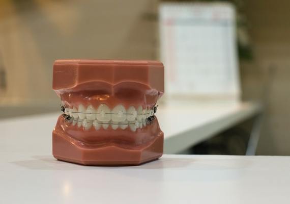 When Is A Good Time For Braces?