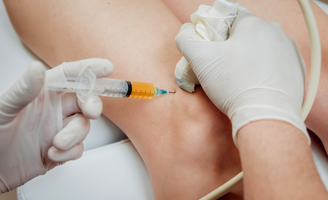 Is Prp Safe? Keypoints About Prp Injection for Pain Relief That You Should Know!